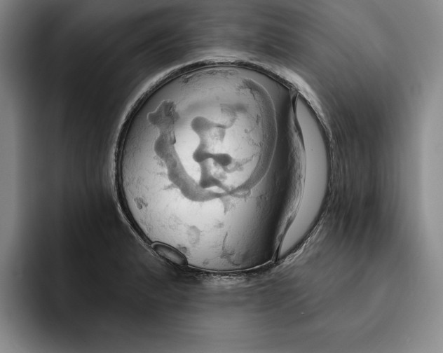 X0000091641183200709201102