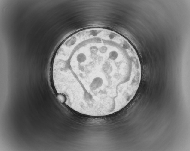 X0000091641187200709201102
