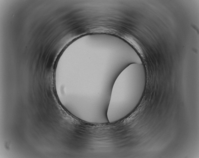 X0000091651000200708231006