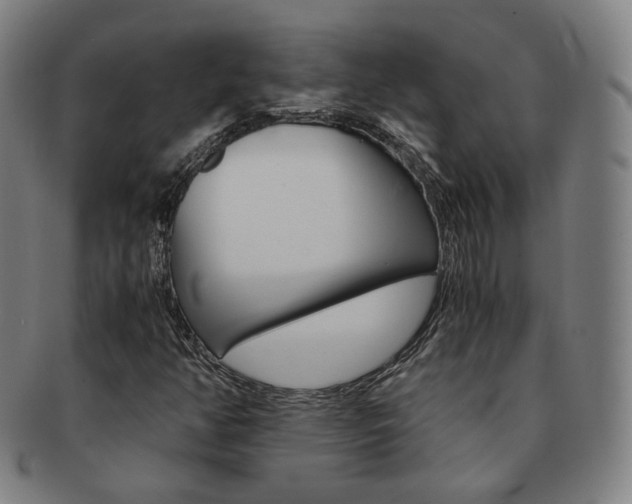 X0000091651350200708231001