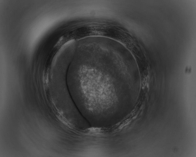 X0000091650052200708301426