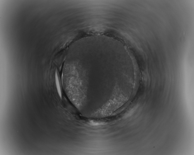 X0000091650818200709201124