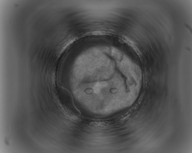 X0000091670297200709201225