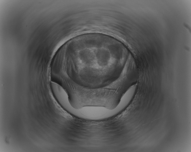 X0000091671522200709201209