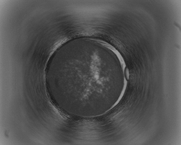 X0000091680626200709131548