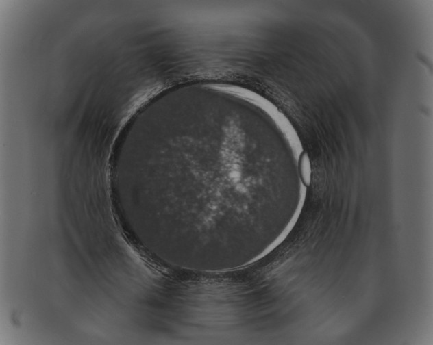 X0000091680626200709201239