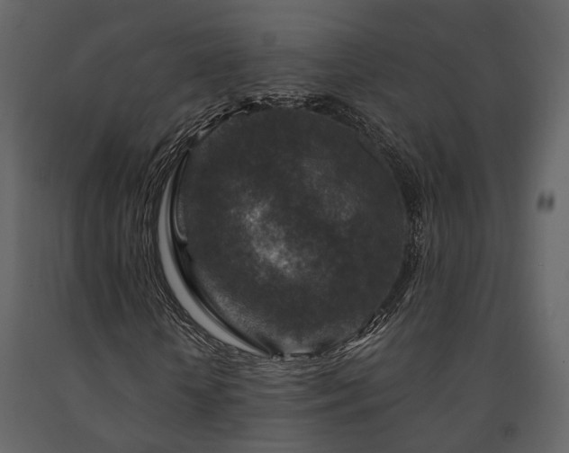 X0000091690818200708231438
