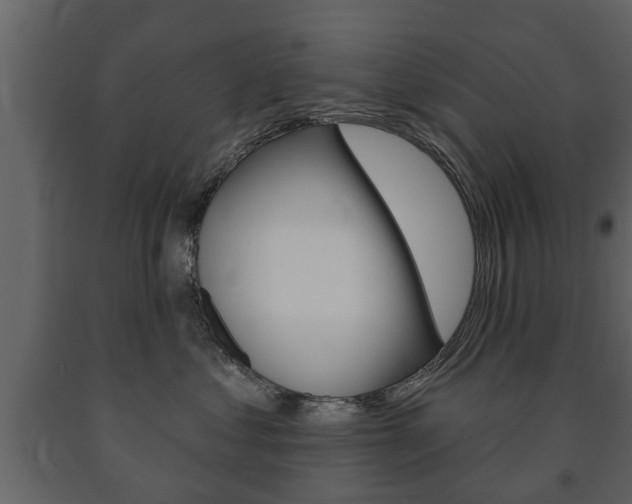 X0000091700621200708240935