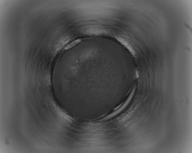 X0000091700399200708311058