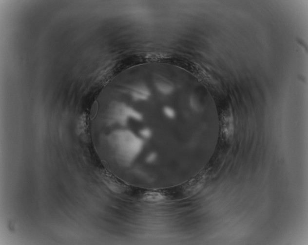 X0000091700519200708311056