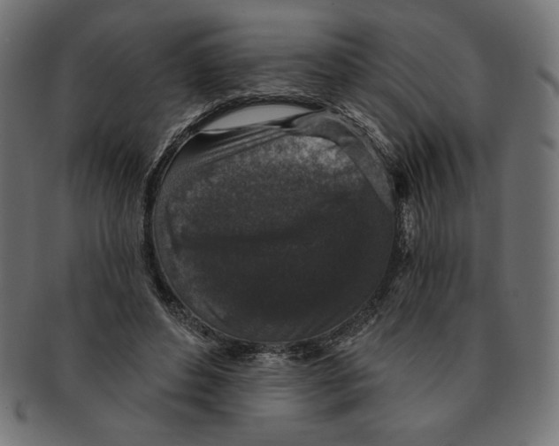 X0000091700496200709210925