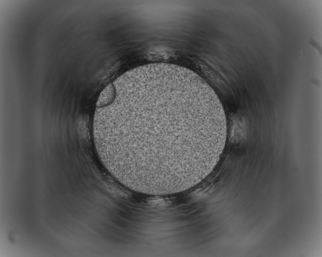 X0000091700616200709210923