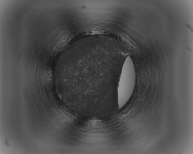 X0000091700748200709210922