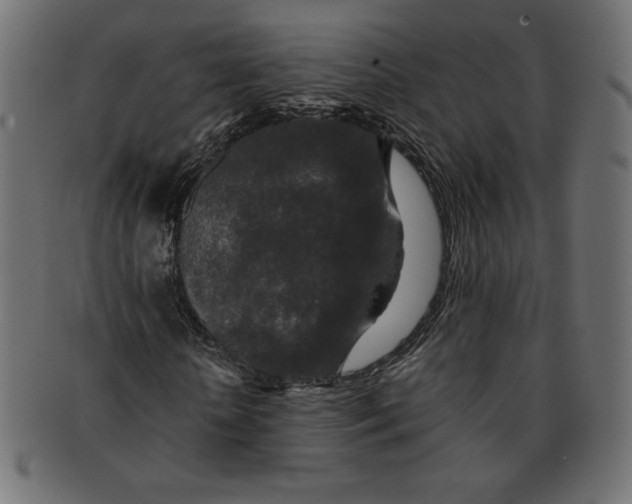 X0000091700818200709210920