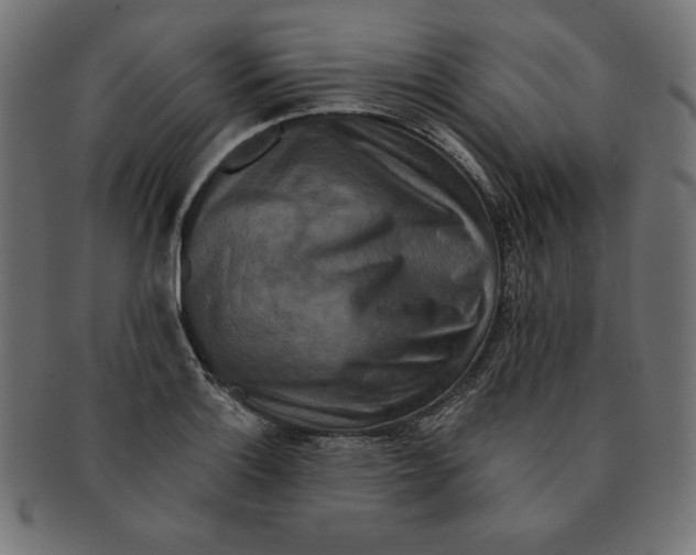 X0000091701132200709210917