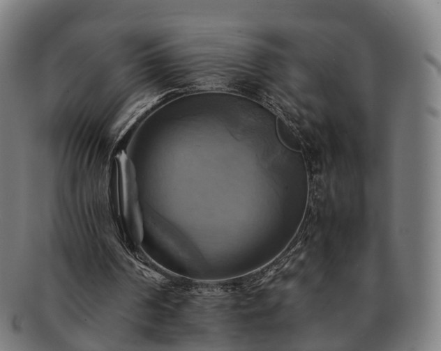 X0000091710194200708311123