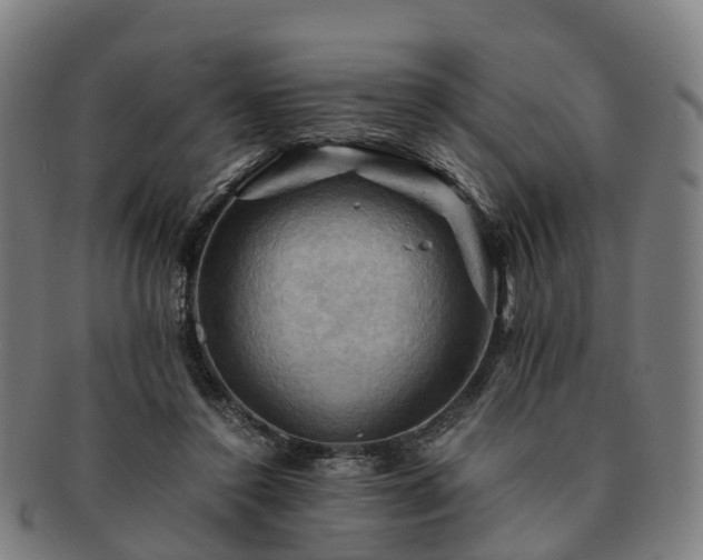 X0000091710356200708311121