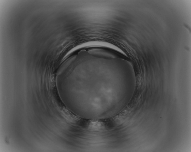 X0000091710376200708311121