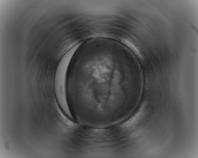 X0000091710849200708311114