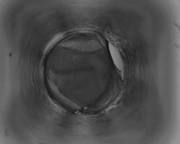 X0000091710197200709210948