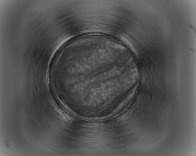 X0000091711076200709210937