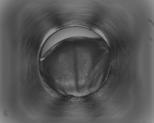 X0000091711146200709210937