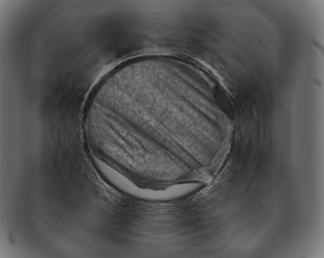 X0000091711168200709210936