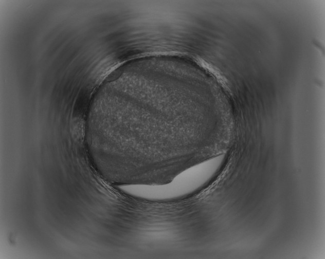 X0000091711169200709210936