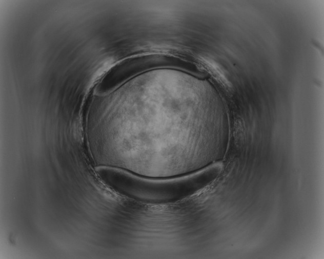 X0000091711172200709210936