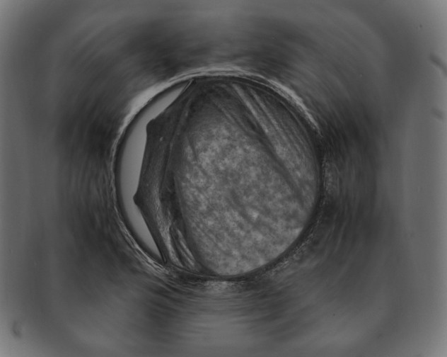 X0000091711176200709210936