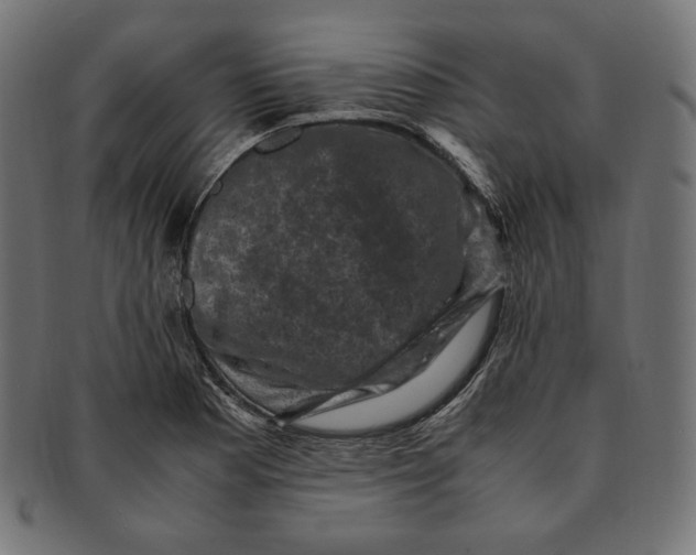 X0000091711177200709210936