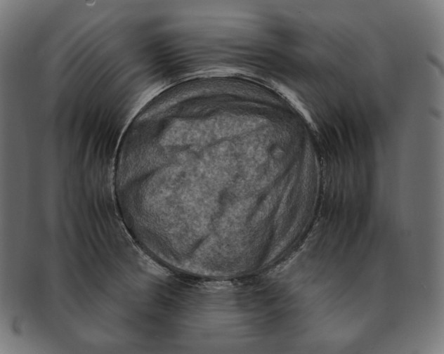 X0000091711186200709210936