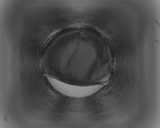 X0000091711206200709210935