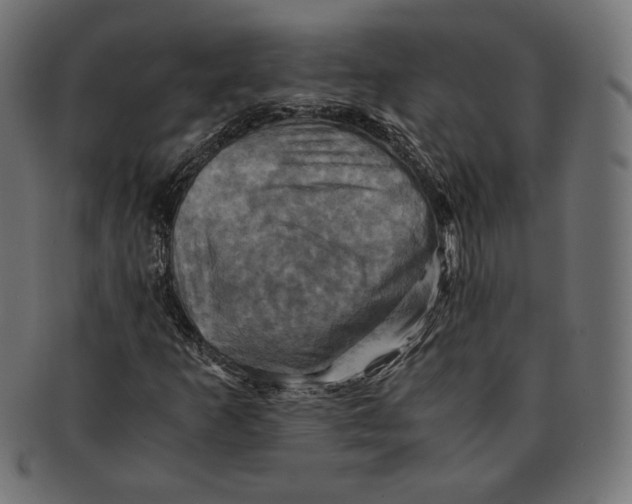 X0000091711253200709210935