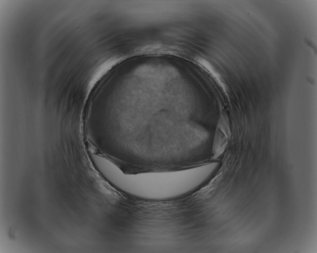 X0000091711336200709210934