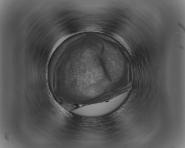 X0000091711339200709210934