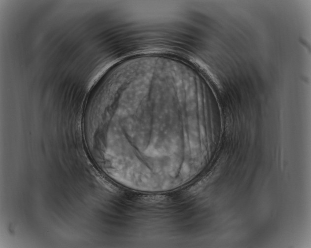 X0000091711417200709210933