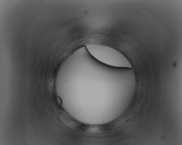 X0000091720177200708241028