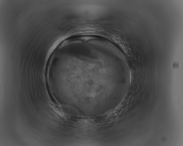 X0000091720147200708241357