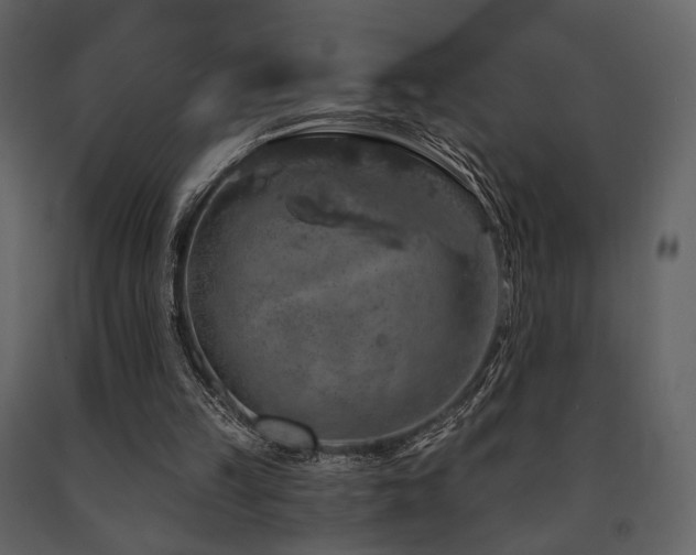 X0000091720149200708241357