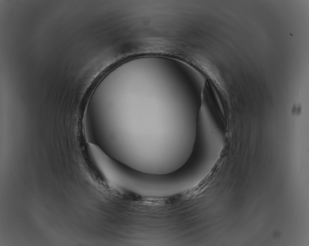 X0000091720156200708241357