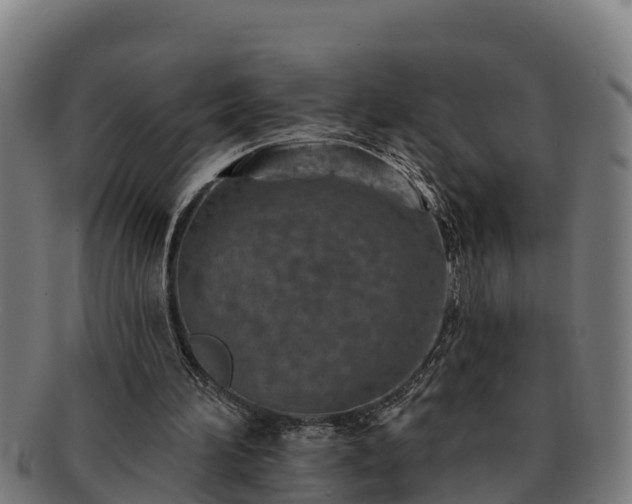 X0000091720196200708311146