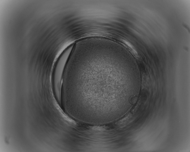 X0000091720796200708311137