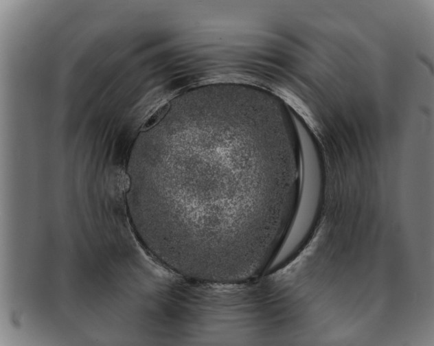 X0000091720849200708311137