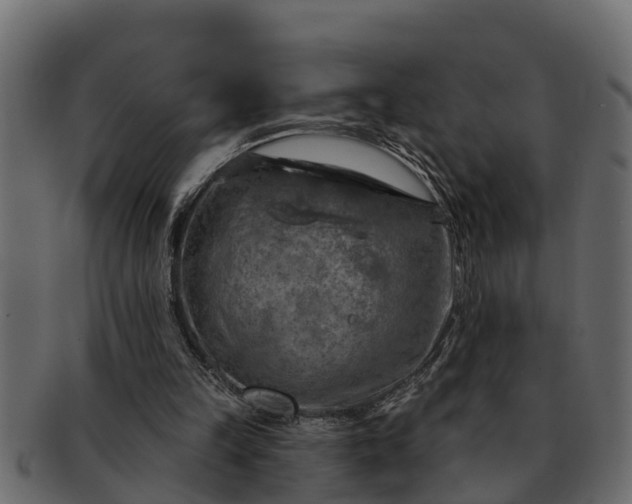 X0000091720149200709071444