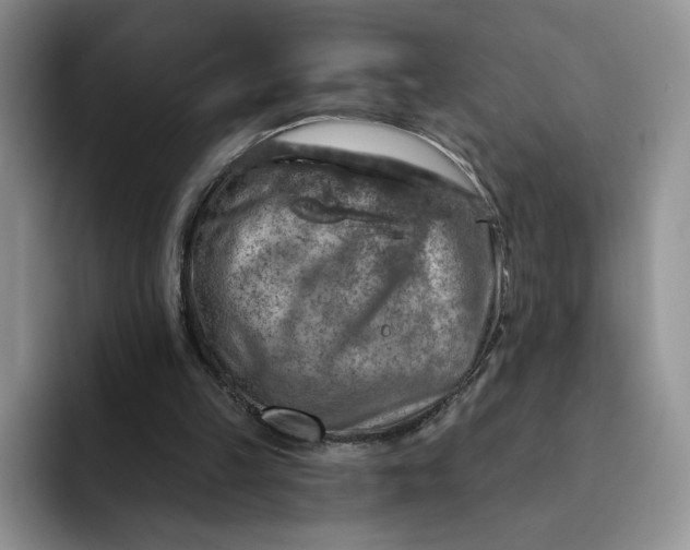 X0000091720149200709141212