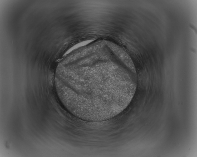 X0000091720038200709211009