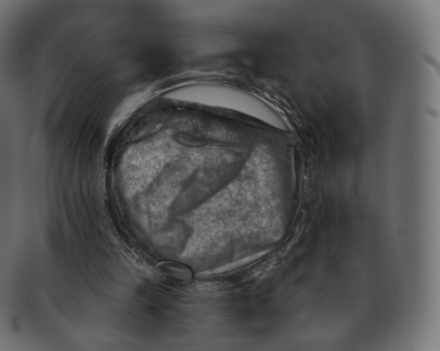 X0000091720149200709211008