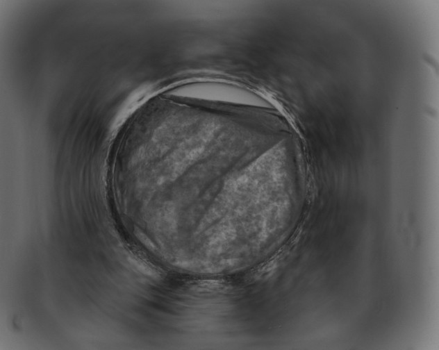 X0000091720151200709211008