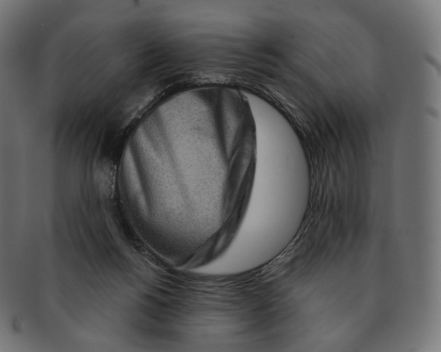 X0000091720168200709211008